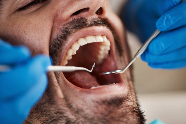 Best Emergency Gum Treatment in Rusk, TX